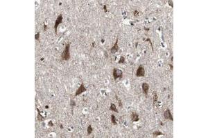 Immunohistochemical staining (Formalin-fixed paraffin-embedded sections) of human cerebral cortex with SORT1 polyclonal antibody  shows strong cytoplasmic positivity in neuronal cells.