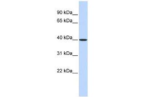 MAT2B antibody used at 1 ug/ml to detect target protein. (MAT2B 抗体  (Middle Region))