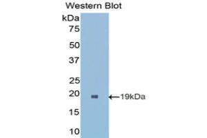 Western Blotting (WB) image for anti-Superoxide Dismutase 1, Soluble (SOD1) (AA 2-154) antibody (ABIN1078539) (SOD1 抗体  (AA 2-154))