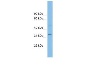 SECTM1 antibody used at 1 ug/ml to detect target protein. (SECTM1 抗体  (Middle Region))