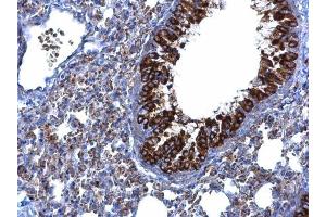 IHC-P Image MTMR9 antibody [C3], C-term detects MTMR9 protein at cytoplasm on mouse lung by immunohistochemical analysis. (MTMR9 抗体  (C-Term))
