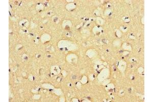 Immunohistochemistry of paraffin-embedded human brain tissue using ABIN7160057 at dilution of 1:100 (MAP3K8 抗体  (AA 1-300))