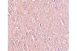 Immunohistochemical staining of human brain cells with LRRTM2 polyclonal antibody  at 2. (LRRTM2 抗体  (C-Term))