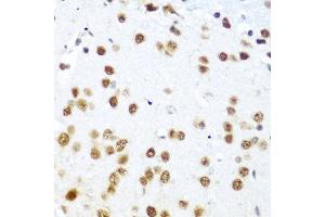 Immunohistochemistry of paraffin-embedded mouse brain using CASP9 antibody at dilution of 1:100 (40x lens). (Caspase 9 抗体)