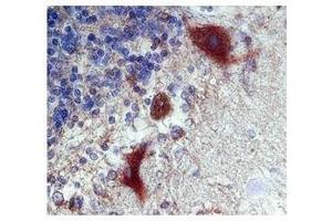 Calbindin 1 in Purkinje neurons in human cerebellum was detected using HRP/DAB brown color stain (CALB1 抗体  (C-Term))