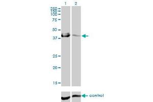 Western blot analysis of CA12 over-expressed 293 cell line, cotransfected with CA12 Validated Chimera RNAi (Lane 2) or non-transfected control (Lane 1). (CA12 抗体  (AA 25-124))