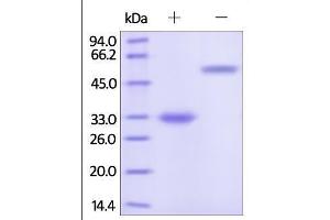 Human IgG4 Fc, Tag Free on SDS-PAGE under reducing (R) and no-reducing (NR) conditions. (HEK-293 Cells IgG4 同型对照)