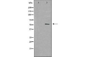 Western blot analysis of extracts from HUVEC cells using PFKFB1 antibody. (PFKFB1 抗体  (C-Term))