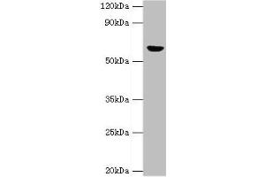 Western blot All lanes: GLUD2 antibody at 2 μg/mL + 293T whole cell lysate Secondary Goat polyclonal to rabbit IgG at 1/10000 dilution Predicted band size: 61 kDa Observed band size: 61 kDa (GLUD2 抗体  (AA 319-558))