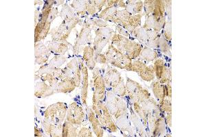 Immunohistochemistry of paraffin-embedded rat heart using MBNL1 antibody (ABIN5975763) at dilution of 1/100 (40x lens). (MBNL1 抗体)