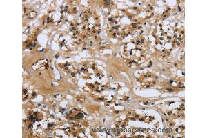 Immunohistochemistry of Human tonsil using LGALS7 Polyclonal Antibody at dilution of 1:50