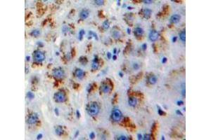 Used in DAB staining on fromalin fixed paraffin-embedded Liver tissue (GOLM1 抗体  (AA 119-223))