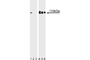 Western Blotting (WB) image for anti-Retinoblastoma 1 (RB1) (pSer780) antibody (ABIN967604) (Retinoblastoma 1 抗体  (pSer780))