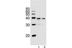 Western blot analysis of lysate from 1) PC3, and 2) LNCaP cell line using VDR antibody at 1:1000. (Vitamin D Receptor 抗体  (AA 274-299))