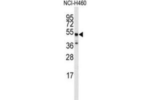 Western Blotting (WB) image for anti-Adrenergic, beta-2-, Receptor, Surface (ADRB2) antibody (ABIN3003093) (beta 2 Adrenergic Receptor 抗体)