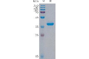 Human S100A9 Protein, hFc Tag on SDS-PAGE under reducing condition.