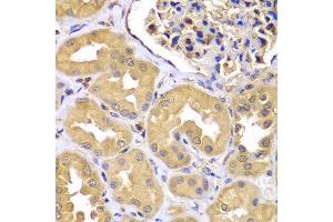 Immunohistochemistry of paraffin-embedded human kidney using LZTR1 antibody at dilution of 1:100 (x400 lens). (LZTR1 抗体)