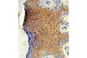 Formalin-fixed and paraffin-embedded human skin tissue reacted with GALNT3 Antibody (Center), which was peroxidase-conjugated to the secondary antibody, followed by DAB staining. (GALNT3 抗体  (AA 454-481))