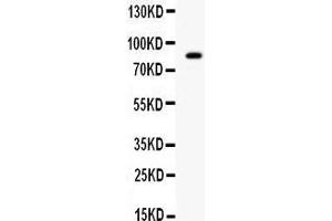 Western blot analysis of SMURF2 expression in SMMC whole cell lysates (lane 1). (SMURF2 抗体  (Middle Region))