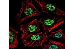 Fluorescent confocal image of HeLa cell stained with NANOG antibody at 1:25. (Nanog 抗体  (AA 15-49))