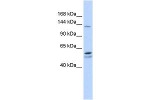 PUM2 antibody used at 1 ug/ml to detect target protein.