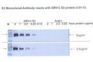Image no. 1 for anti-Glycoprotein E2 antibody (ABIN1742586) (Glycoprotein E2 抗体)