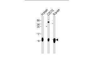 Western Blotting (WB) image for anti-S100 Calcium Binding Protein B (S100B) antibody (ABIN651265)