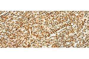 Immunohistochemistry of paraffin-embedded Human tonsil tissue using HNRNPA3 Polyclonal Antibody at dilution of 1:45(x200) (HNRNPA3 抗体)