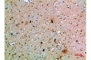 Immunohistochemical analysis of paraffin-embedded human-brain, antibody was diluted at 1:200 (PDGFC 抗体  (AA 61-110))