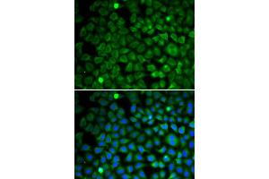 Immunofluorescence analysis of U2OS cells using NUP62 antibody. (NUP62 抗体)