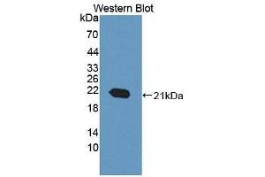 Detection of Recombinant ACD, Mouse using Polyclonal Antibody to Adrenocortical Dysplasia Homolog (ACD) (ACD 抗体  (AA 21-175))