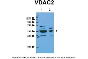Western Blotting (WB) image for anti-Voltage-Dependent Anion Channel 2 (VDAC2) (N-Term) antibody (ABIN2776154)