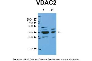 WB Suggested Anti-VDAC2 Antibody    Titration:  1. (VDAC2 抗体  (N-Term))