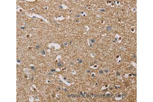 Immunohistochemistry of Human brain  using PIP4K2A Polyclonal Antibody at dilution of 1:40 (PIP4K2A 抗体)