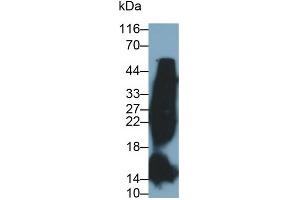 Detection of HbA1c in Human Blood Cells lysate using Monoclonal Antibody to Glycated Hemoglobin A1c (HbA1c) (HbA1c 抗体)
