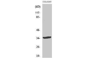 Western Blotting (WB) image for anti-Ubiquitin Thioesterase OTU1 (YOD1) (Internal Region) antibody (ABIN3186223) (YOD1 抗体  (Internal Region))
