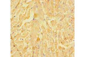 Immunohistochemistry of paraffin-embedded human heart tissue using ABIN7158138 at dilution of 1:100 (LRRC15 抗体  (AA 301-538))