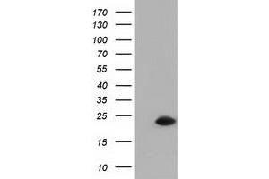 Western Blotting (WB) image for anti-Retinoblastoma Binding Protein 9 (RBBP9) antibody (ABIN1500627) (RBBP9 抗体)