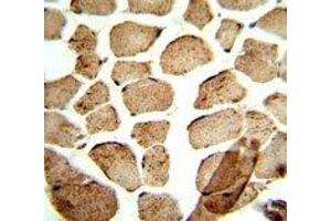 IHC analysis of FFPE human skeletal muscle stained with ULK1 antibody (ULK1 抗体)