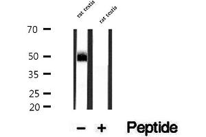 Western blot analysis of extracts of rat testis tissue, using DYX1C1 antibody. (DYX1C1 抗体)