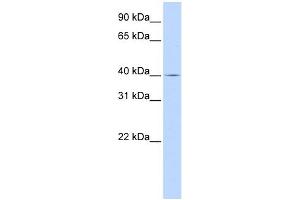 SLC22A18 antibody used at 1 ug/ml to detect target protein. (ORCTL-2/SLC22A18 抗体  (Middle Region))