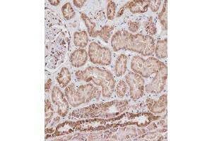 Immunohistochemistry (Paraffin-embedded Sections) (IHC (p)) image for anti-Voltage-Dependent Anion Channel 2 (VDAC2) (AA 51-85), (N-Term) antibody (ABIN6242882)