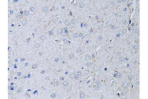 Immunohistochemistry of paraffin-embedded rat brain using RYR2 Antibody (ABIN5970123) at dilution of 1/100 (40x lens). (RYR2 抗体)