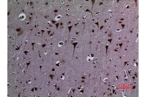 Immunohistochemistry (IHC) image for anti-Heat Shock Protein 90 (HSP90) (acLys284), (acLys292) antibody (ABIN3181886)