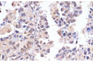 Immunohistochemistry (Paraffin-embedded Sections) (IHC (p)) image for anti-P53-Induced Death Domain Protein (PIDD) antibody (ABIN7261141)
