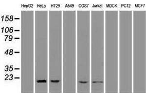 Western blot analysis of extracts (35 µg) from 9 different cell lines by using anti-AK1 monoclonal antibody. (Adenylate Kinase 1 抗体)