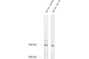 dilution: 1 : 200, sample: crude synaptosomal fraction of rat brain (P2) (Synaptojanin 1 抗体  (Isoform 2))