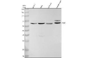 Western blot analysis of PAK1 using anti-PAK1 antibody (ABIN7605844).