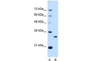 PSME3 antibody used at 0. (PSME3 抗体  (N-Term))