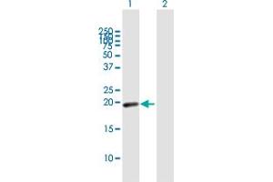 Western Blot analysis of MYL7 expression in transfected 293T cell line by MYL7 MaxPab polyclonal antibody. (MYL7 抗体  (AA 1-175))